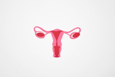 PCOS e alimentazione: cosa sapere e come intervenire