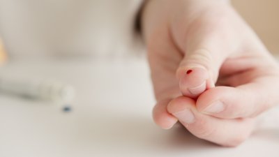 Glicemia alta: cause, sintomi e alimentazione corretta